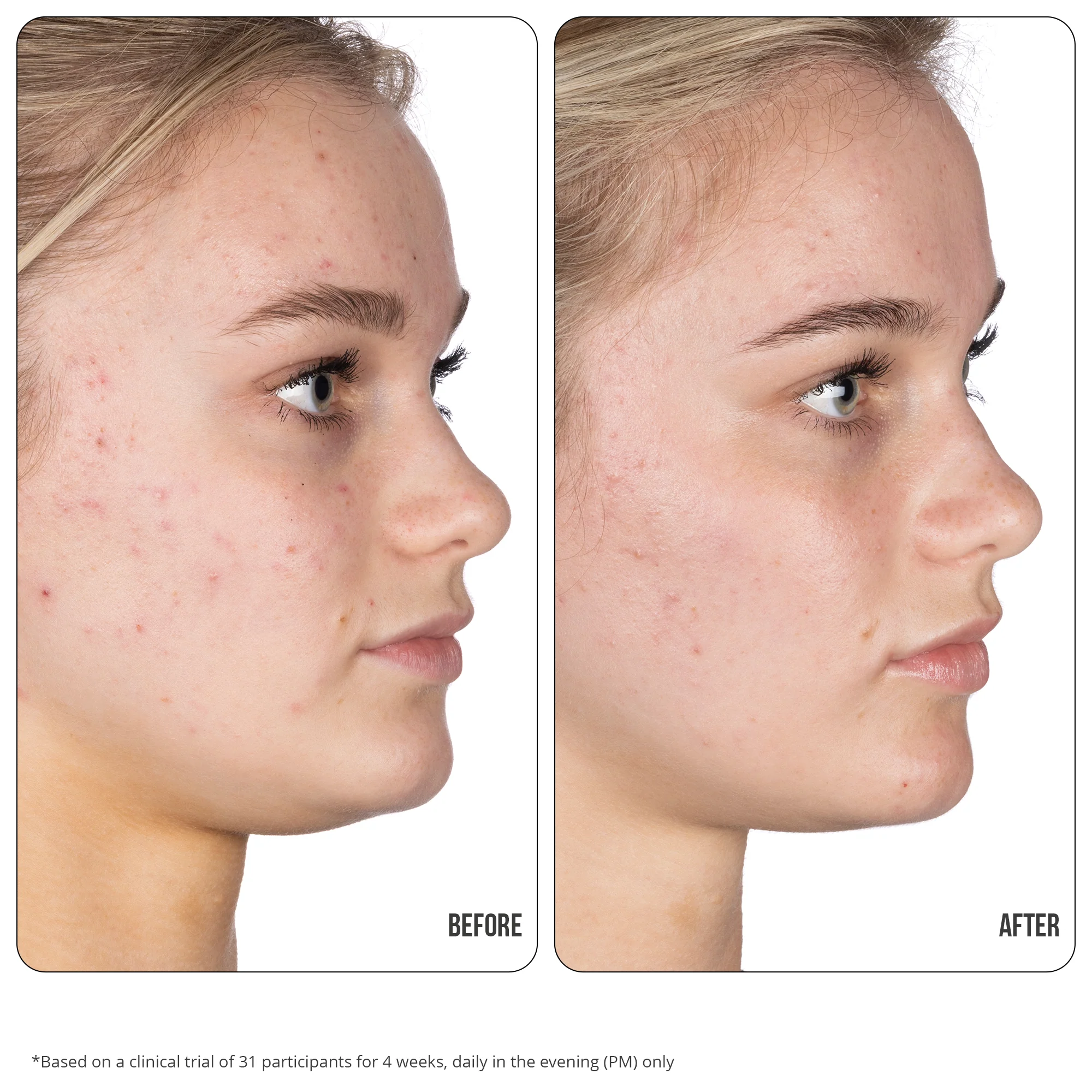 Retinol Fix Blemish Gel Treatment 10% 15ml - Image 3